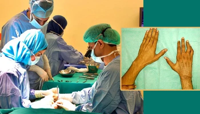 Omani doctors reattach expatriate's severed hand