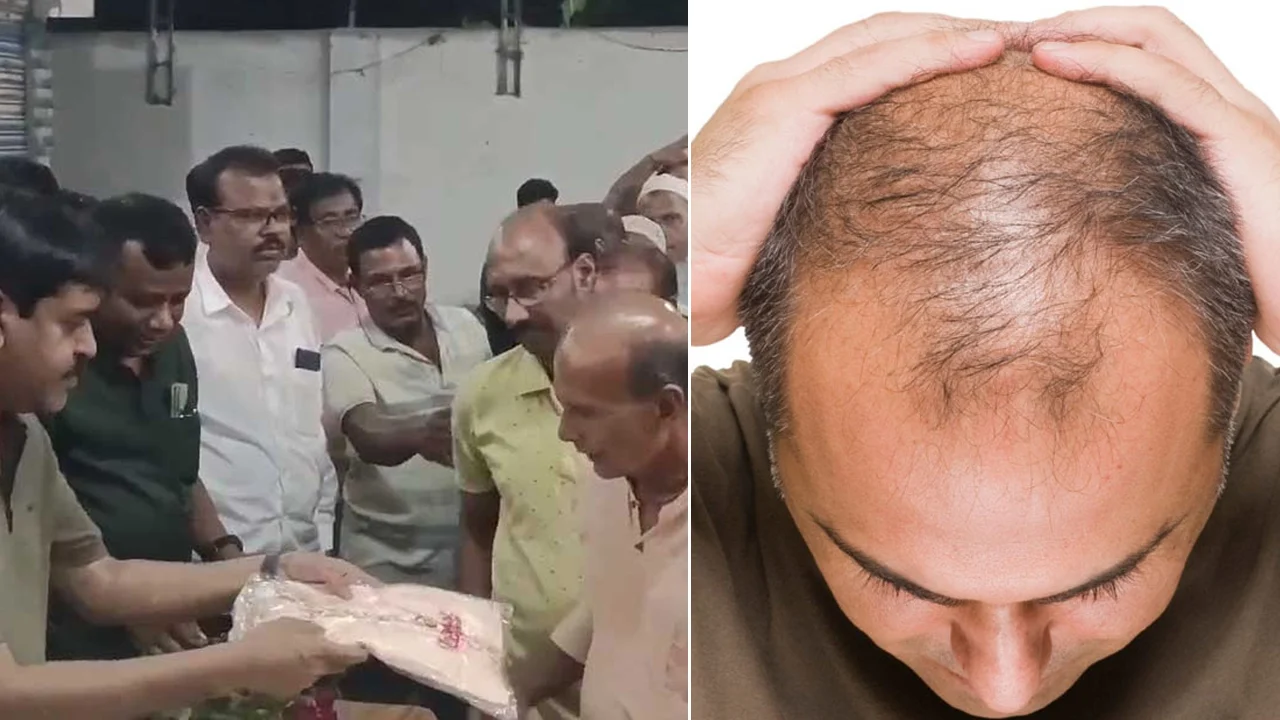 মাথায় টাক মানেই ‘বুদ্ধিমান জ্ঞানী’, মিলল সংবর্ধনা!