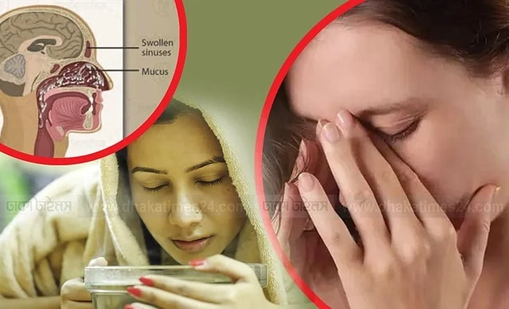 ঠান্ডায় বন্ধ নাক খোলার প্রাকৃতিক ঘরোয়া উপায়