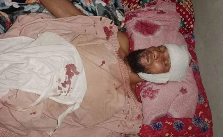 হাতিয়ায় ২ প্রবাসীর ওপর সন্ত্রাসী হামলা, আটক ১